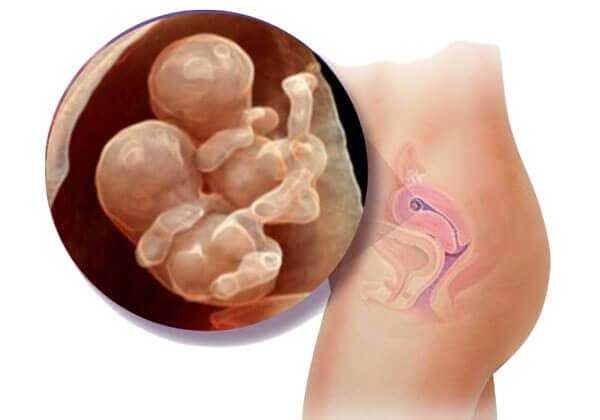 Medicina Fetal Avanzada – ecografía precoz gemelos