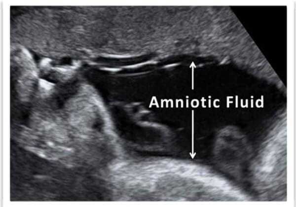 Medicina Fetal Avanzada –