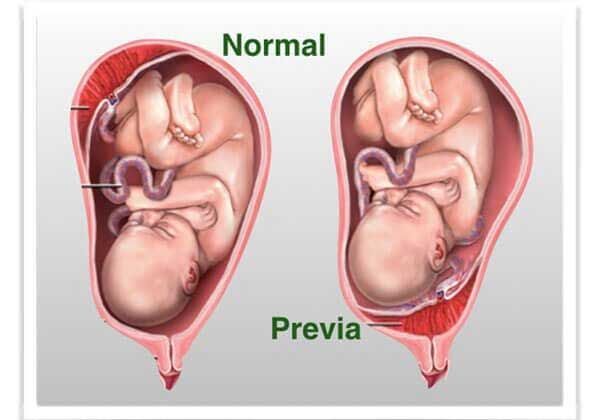 Medicina Fetal Avanzada –