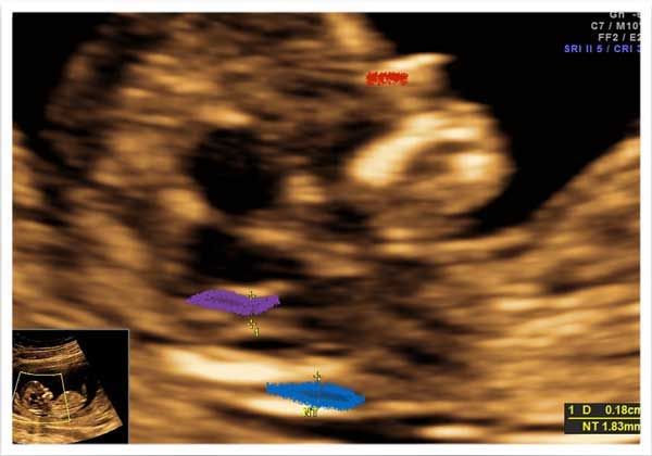 Medicina Fetal Avanzada –