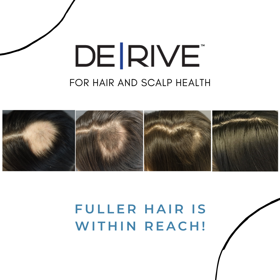 DERIVE hair and scalp health ad with scalp photos and text “FULLER HAIR IS WITHIN REACH!”