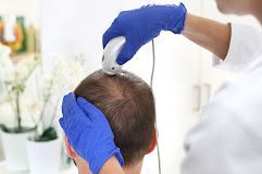Gloved hands measuring a person's scalp with calipers in a clinic setting