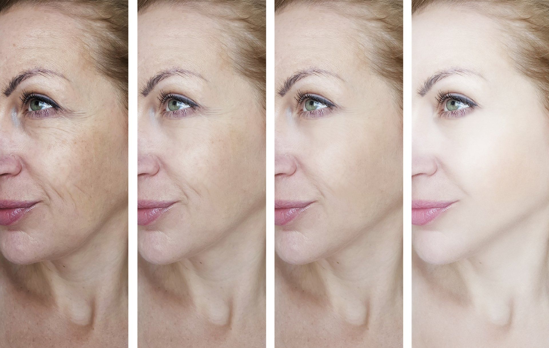 A woman's face with progressively smoother skin, likely representing an anti-aging process; the last image appears airbrushed.