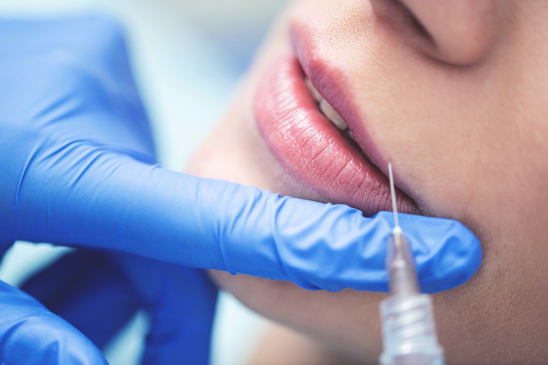A person receiving a lip filler injection. A gloved hand holds a syringe near the lip.