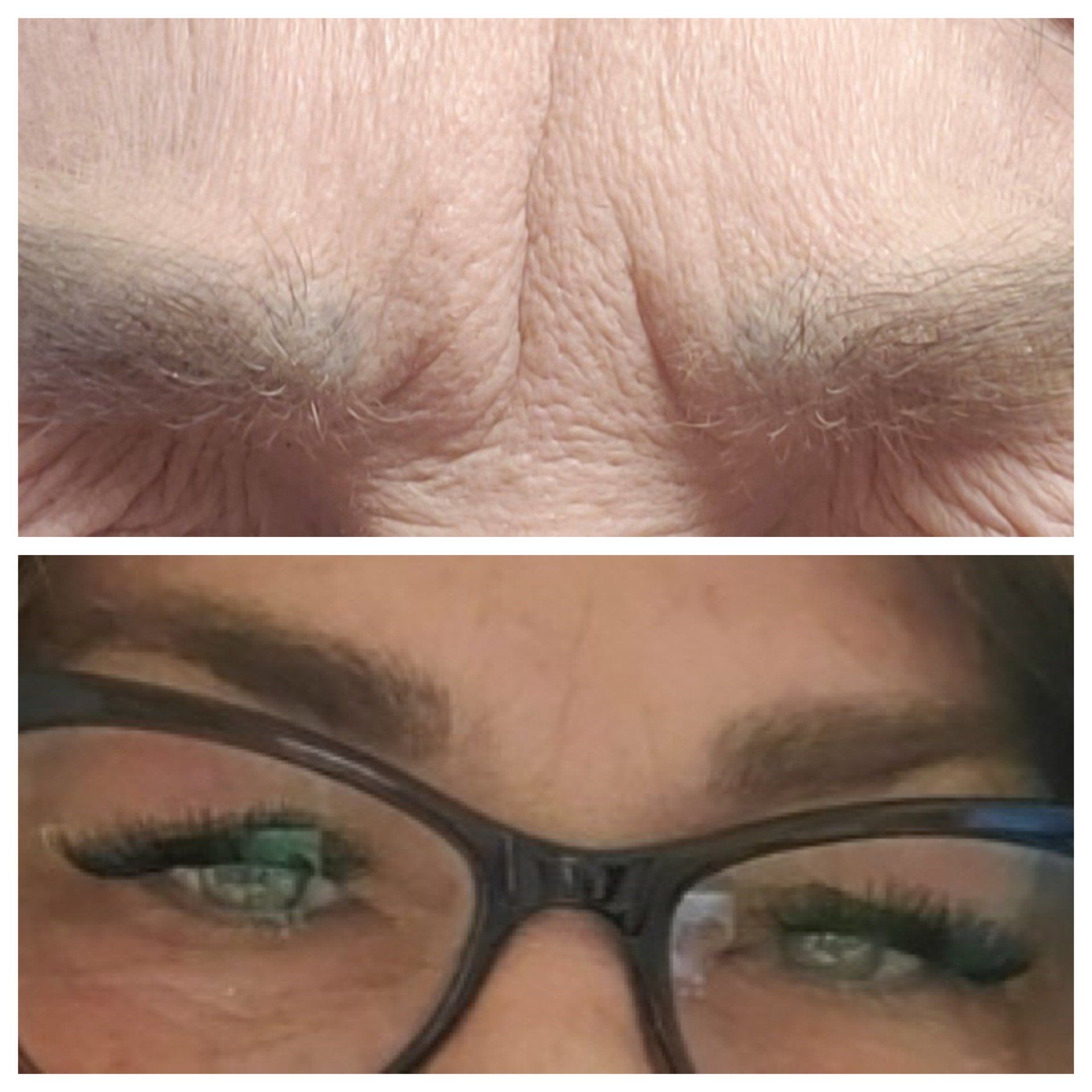 Top: Close-up of wrinkled forehead with deep lines. Bottom: Eyes with glasses and full eyelashes; smooth forehead.