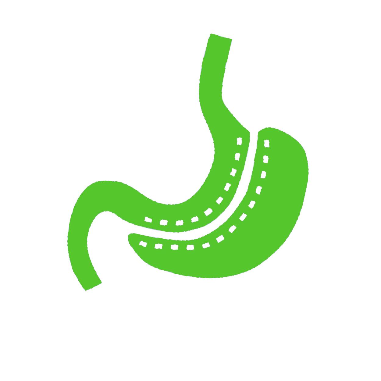 Weight Loss Surgery Brisbane Dr Hatzifotis Bariatric Surgeon