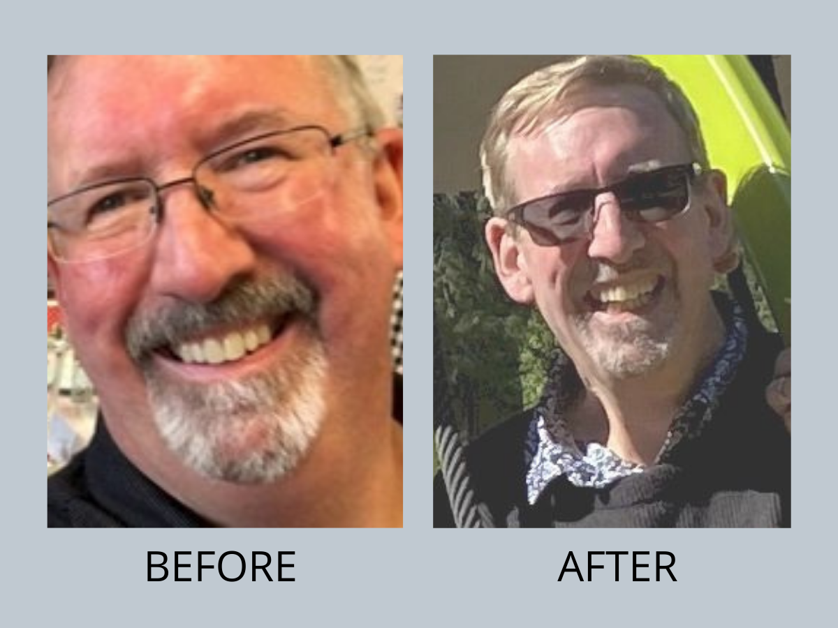 Weightloss Journey, Dr Hatzifotis