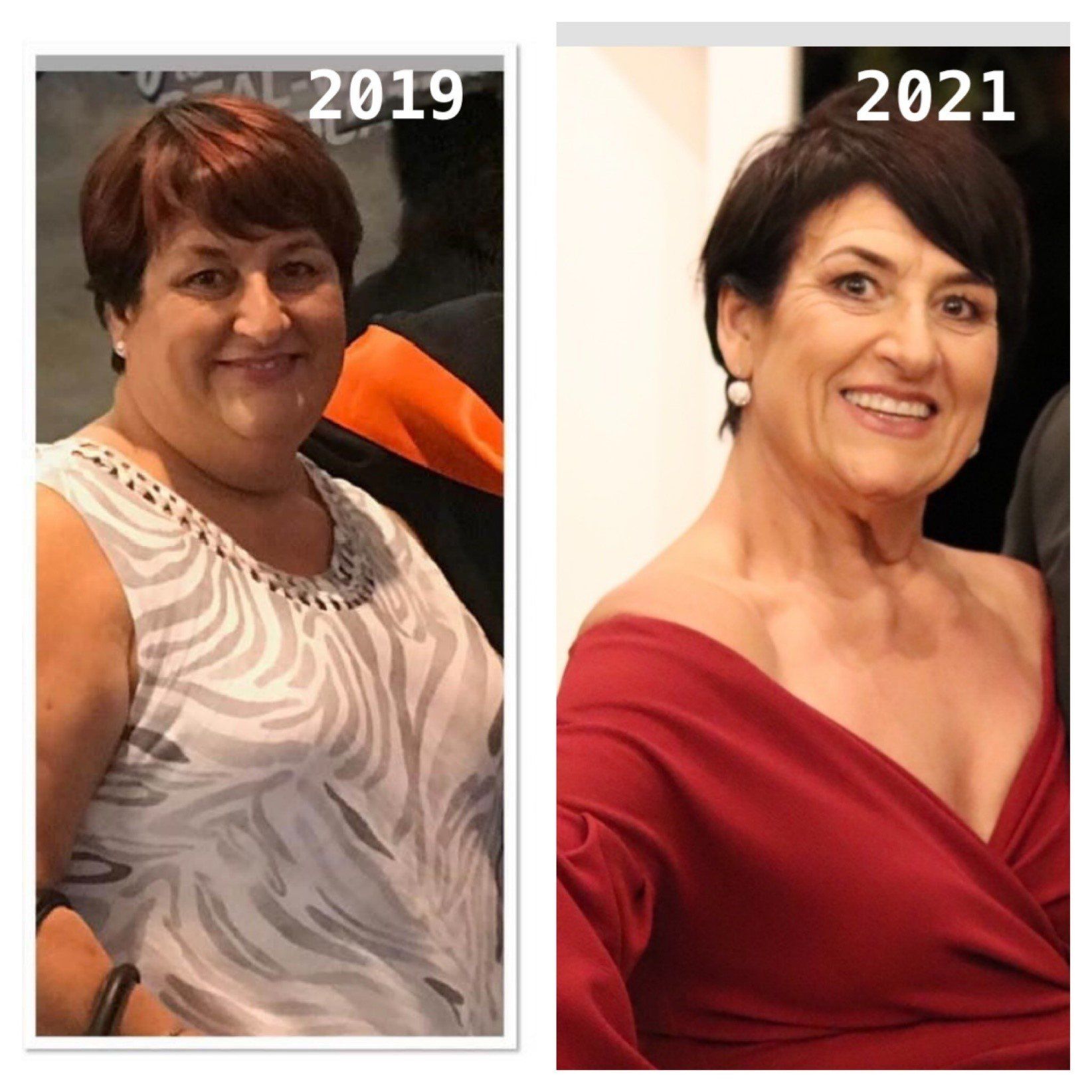Weightloss Journey, Dr Hatzifotis
