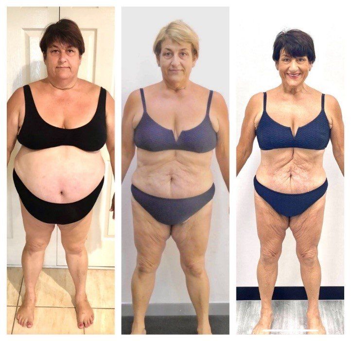 Lee Lost 45kg post-surgery