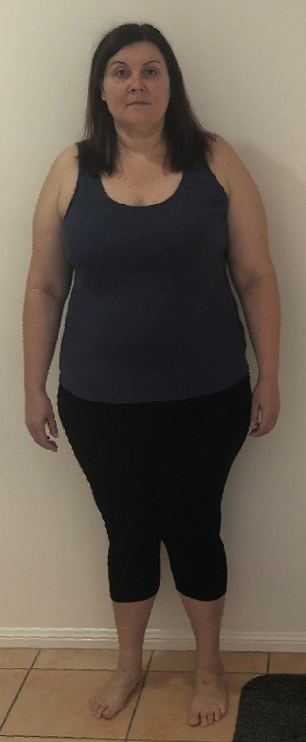 Weightloss Journey, Dr Hatzifotis