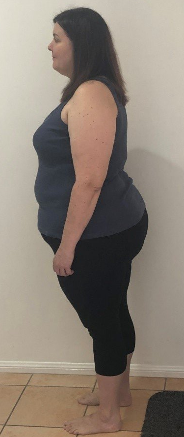 Weightloss Journey, Dr Hatzifotis