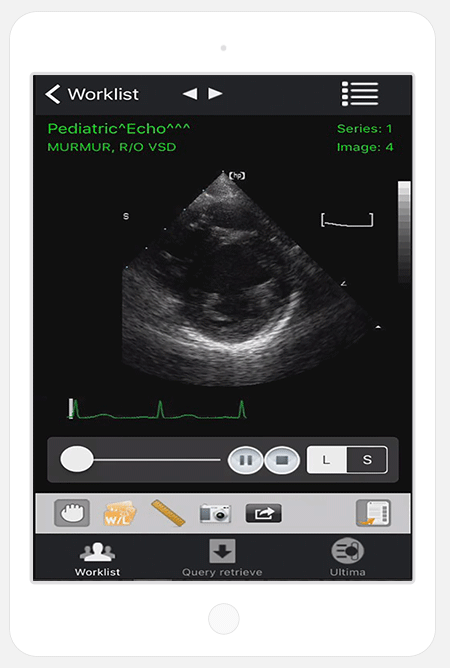 iPaxera viewing tools and DICOM cine playback