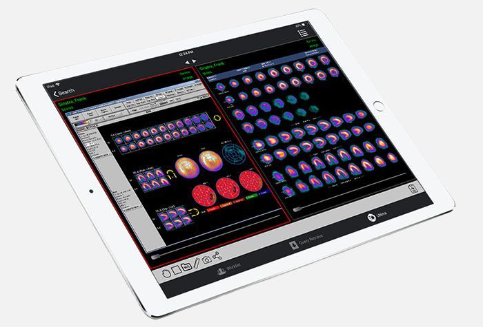 iPaxera mobile DICOM viewer - empower your mobile advantage