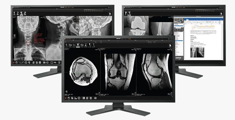 PaxeraOrthopedic