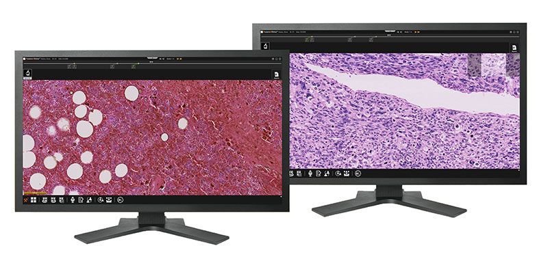 PaxeraPathology