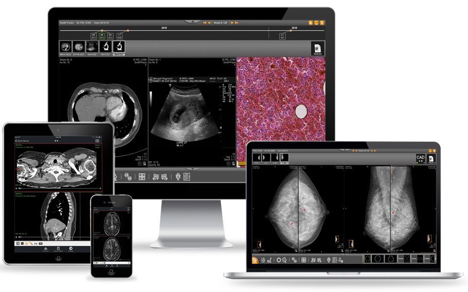 Paxera Ultima All Devices