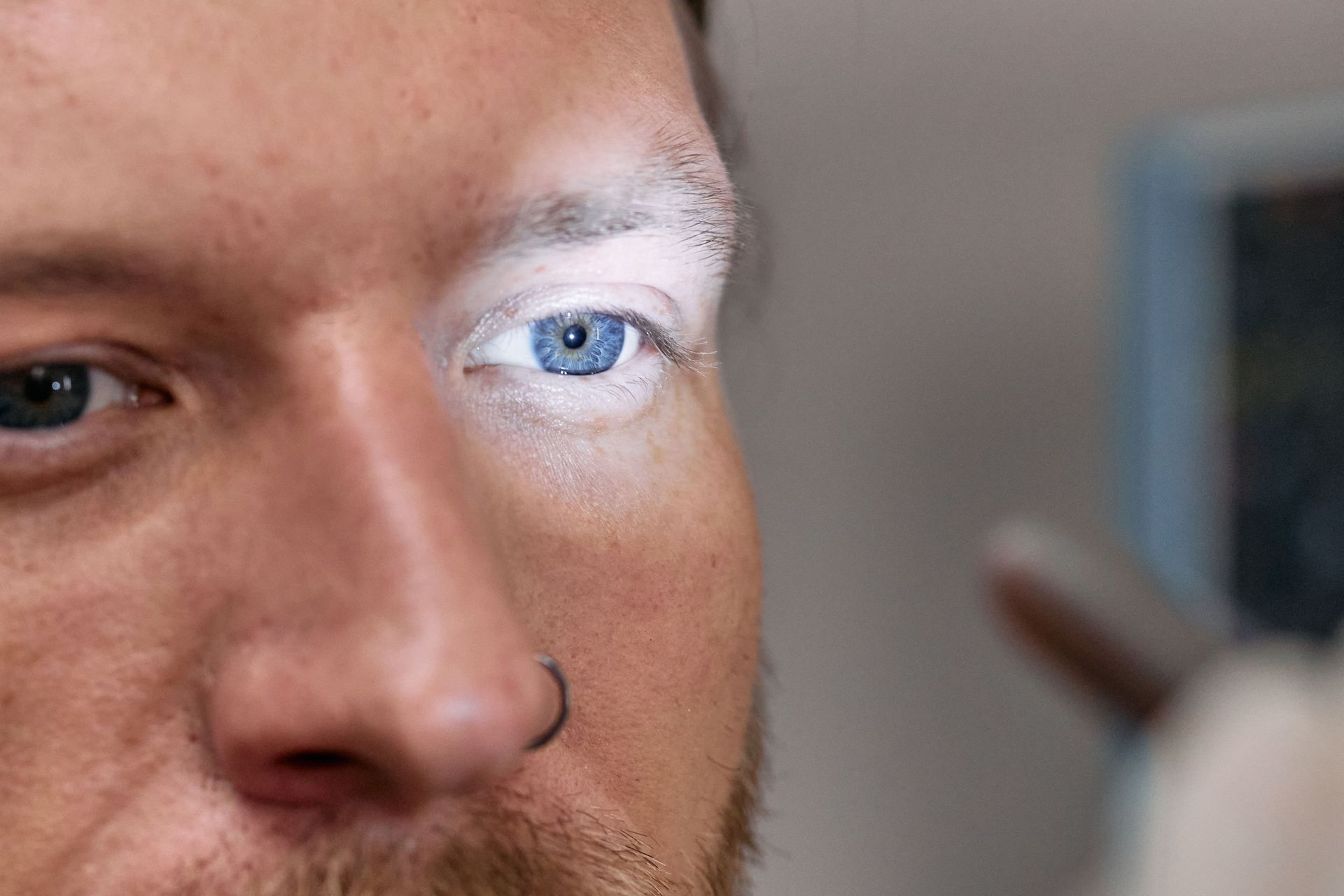 Black Spot on the Eye White