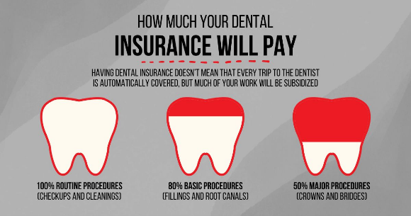 Dental insurance infographic with three tooth icons showing coverage levels: low, medium, and high. Dental insurance infographic with three tooth icons showing coverage levels: low, medium, and high.