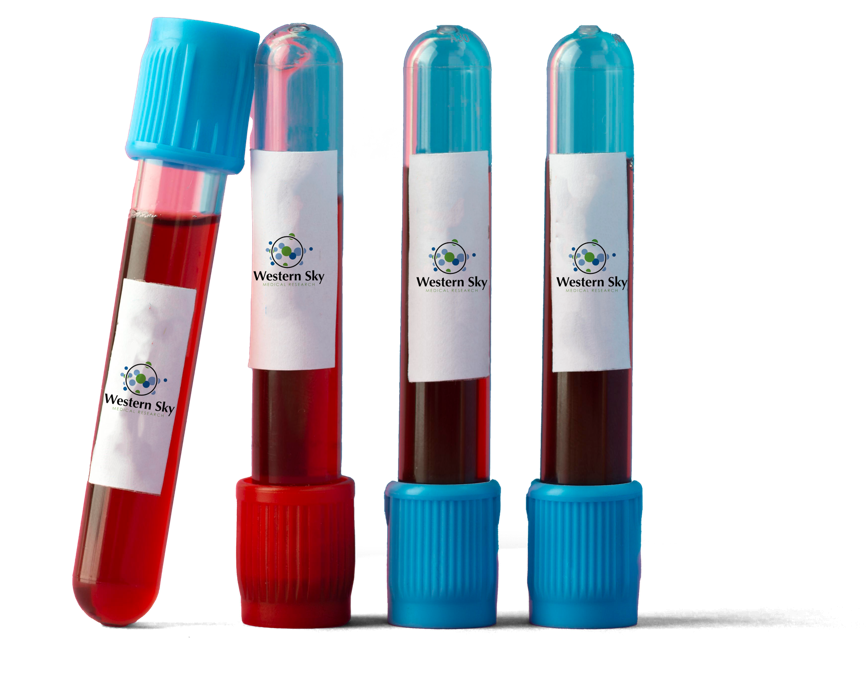 Four laboratory test tubes containing red fluid stand against a white background; three have blue caps and one has a red cap.