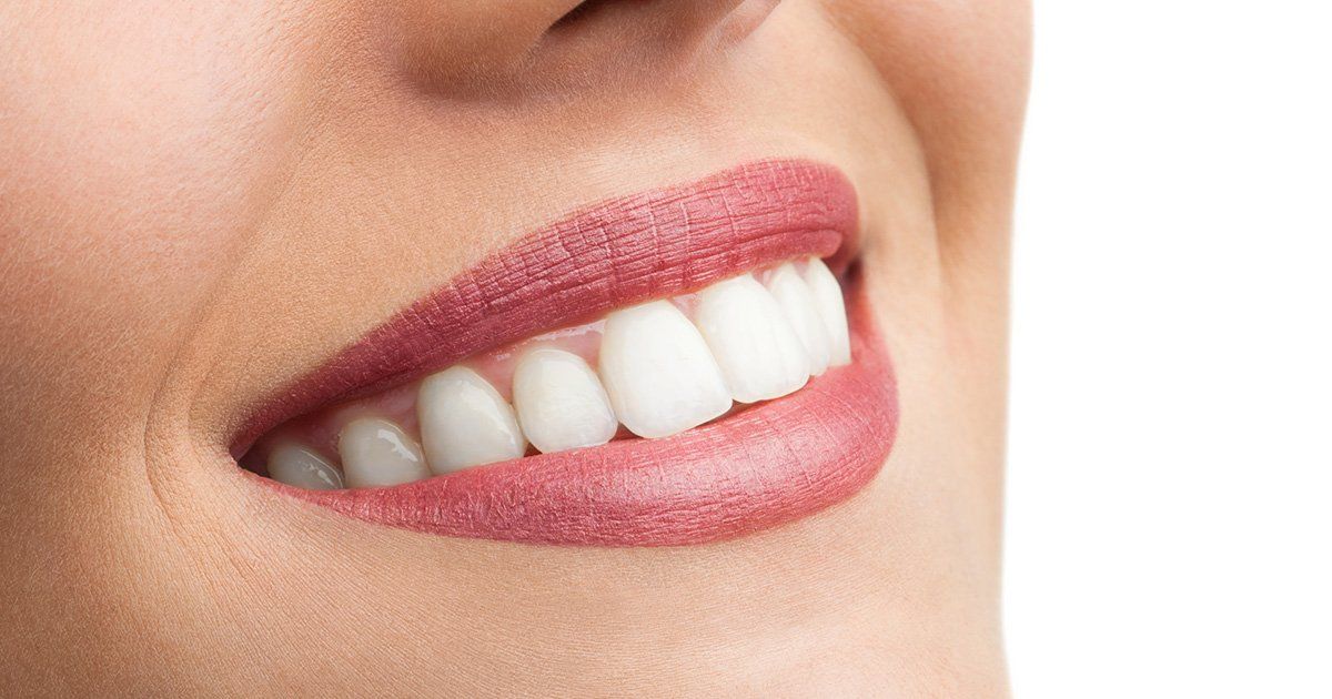 Dental Bonding, Dentist in Honesdale PA