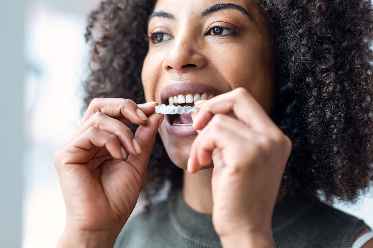 Person inserting a clear dental aligner into their mouth