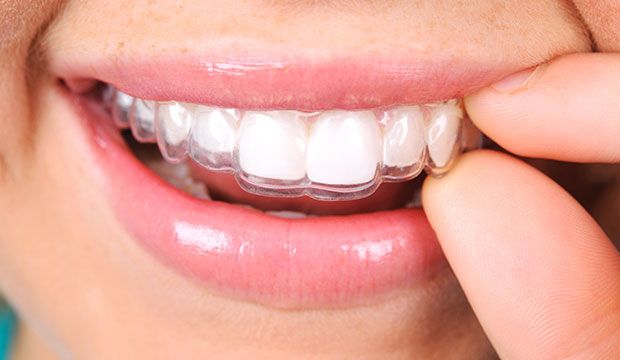 DR. ANTONIO ALCÁZAR FRANCO, DENTISTA ESPECIALISTA EN NIÑOS