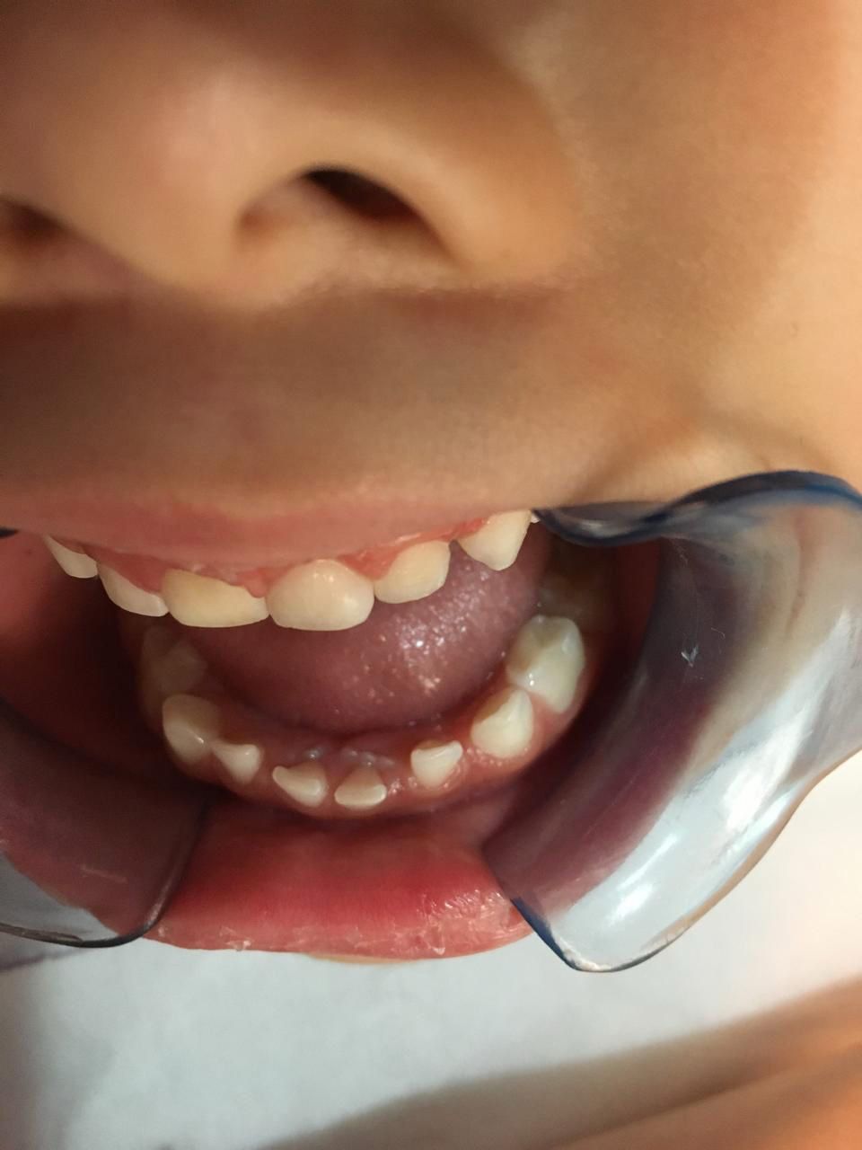 DR. ANTONIO ALCÁZAR FRANCO, DENTISTA ESPECIALISTA EN NIÑOS