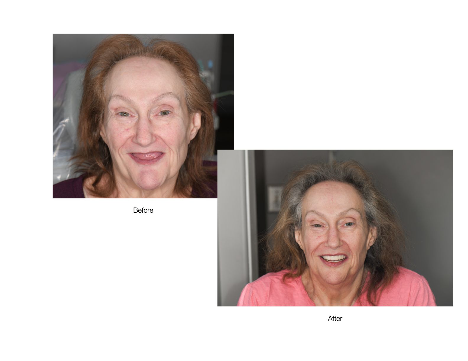 Before and after photos of woman with makeup, smiling, brown hair, indoor settings.