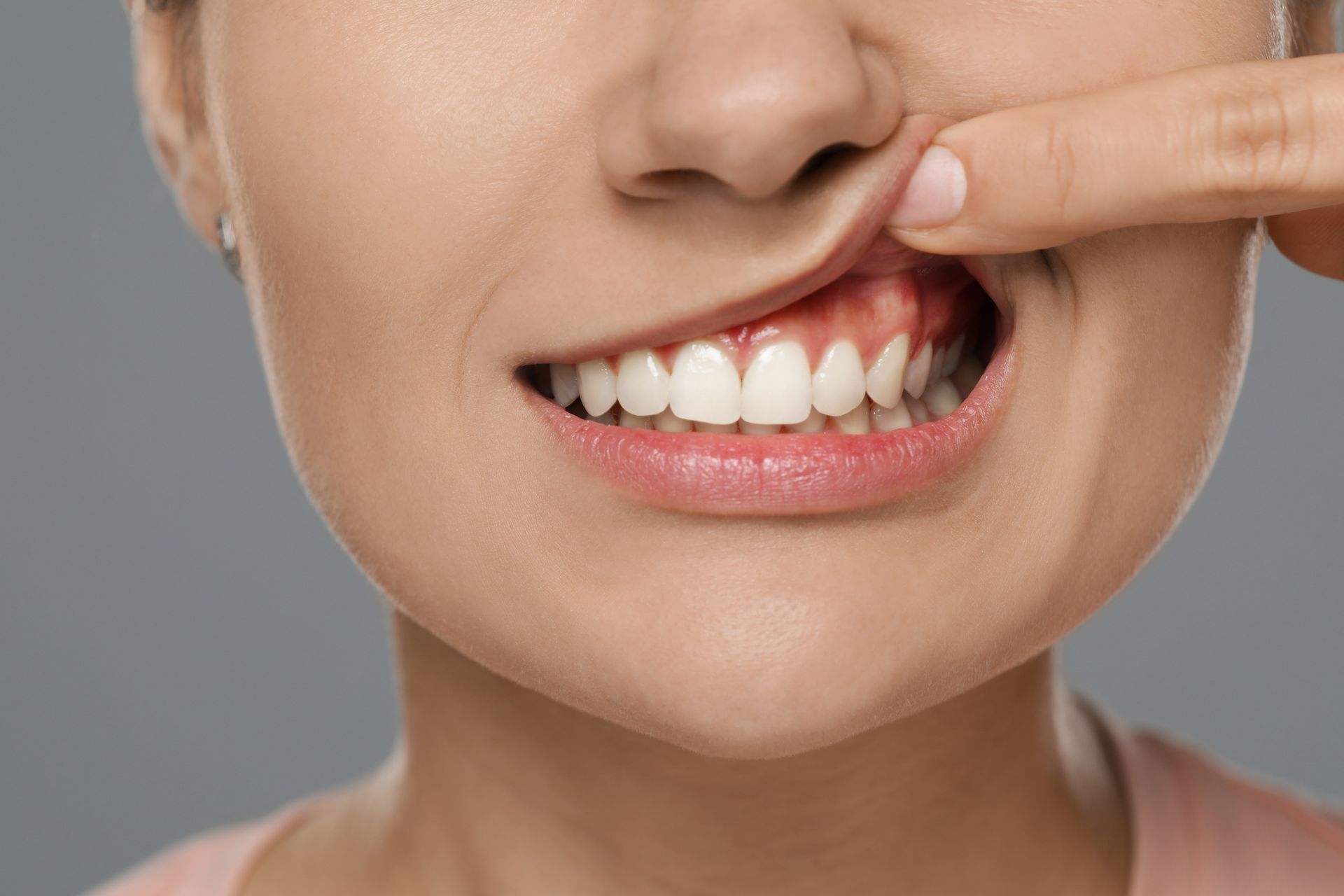Close-up of a smiling mouth with a finger pointing to a chipped front tooth