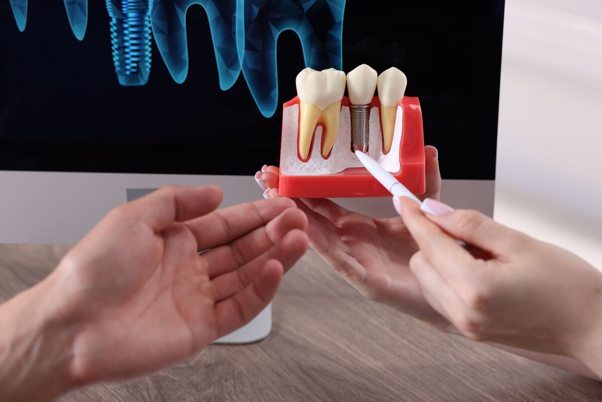Hands examining a dental tooth model with a mirror on a desk, with x-ray images in the background