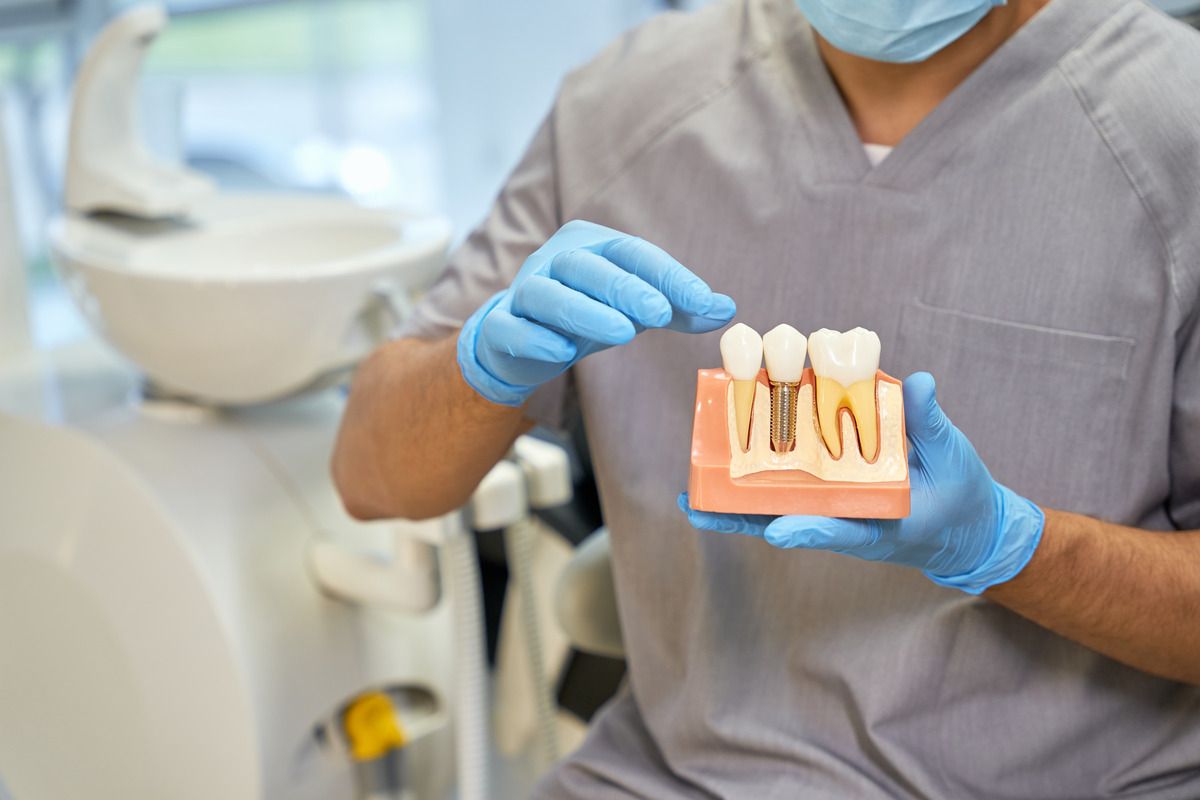 Get dental implants from our family dentist in Longmont, CO A dentist is holding a model of a dental implant.