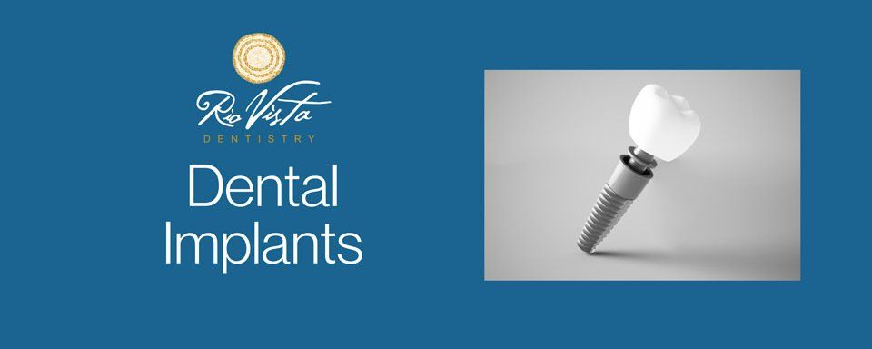 dental implants