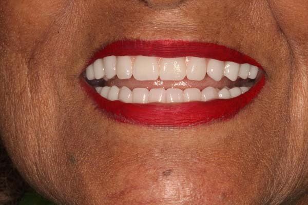 Close-up of a smiling mouth with red lipstick and white teeth