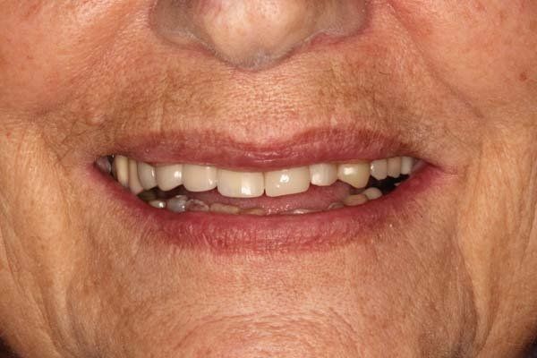 Close-up of a smiling mouth with teeth visible and lips slightly parted