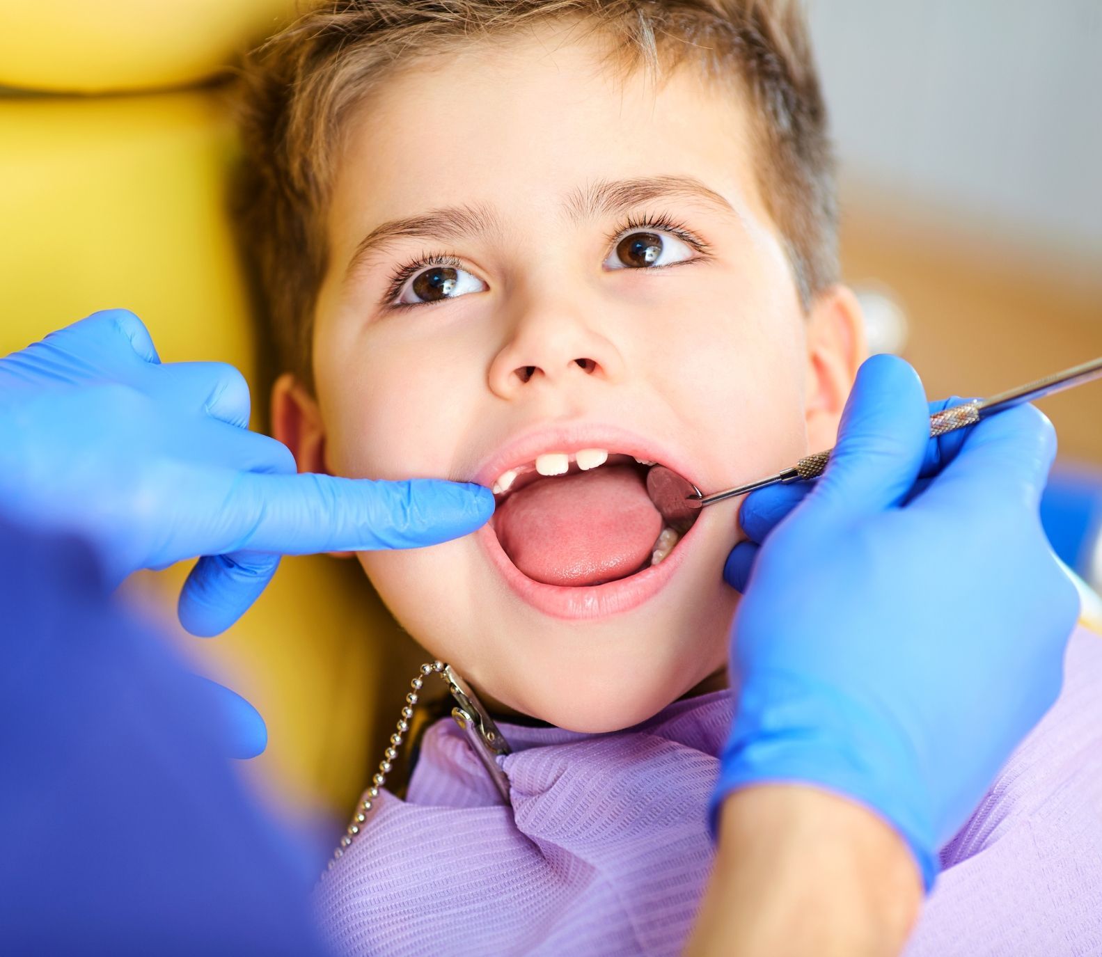 Kiddsmiles Pediatric Dentistry Frenectomies, Floral Park, white plains, westchester, manhasset, merrick, holbrook, syosset, port jefferson station, north babylon, nassau county, suffolk county