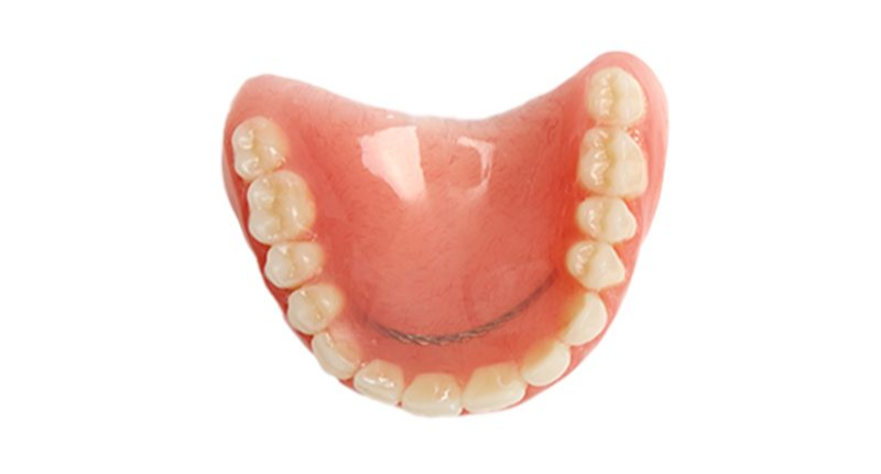 Top view of a lower dental arch model with pink gums and white teeth