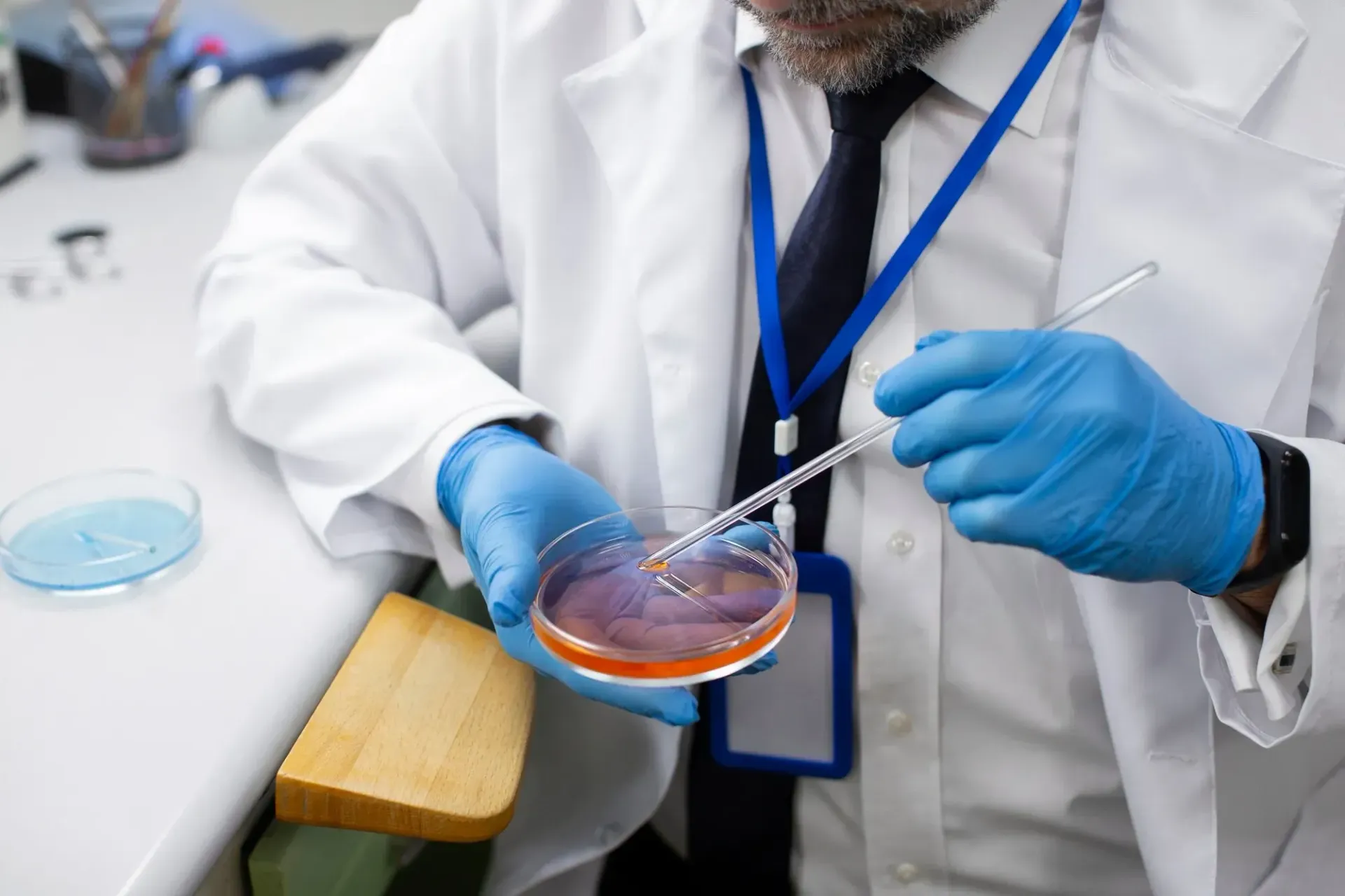 Uro oncologie