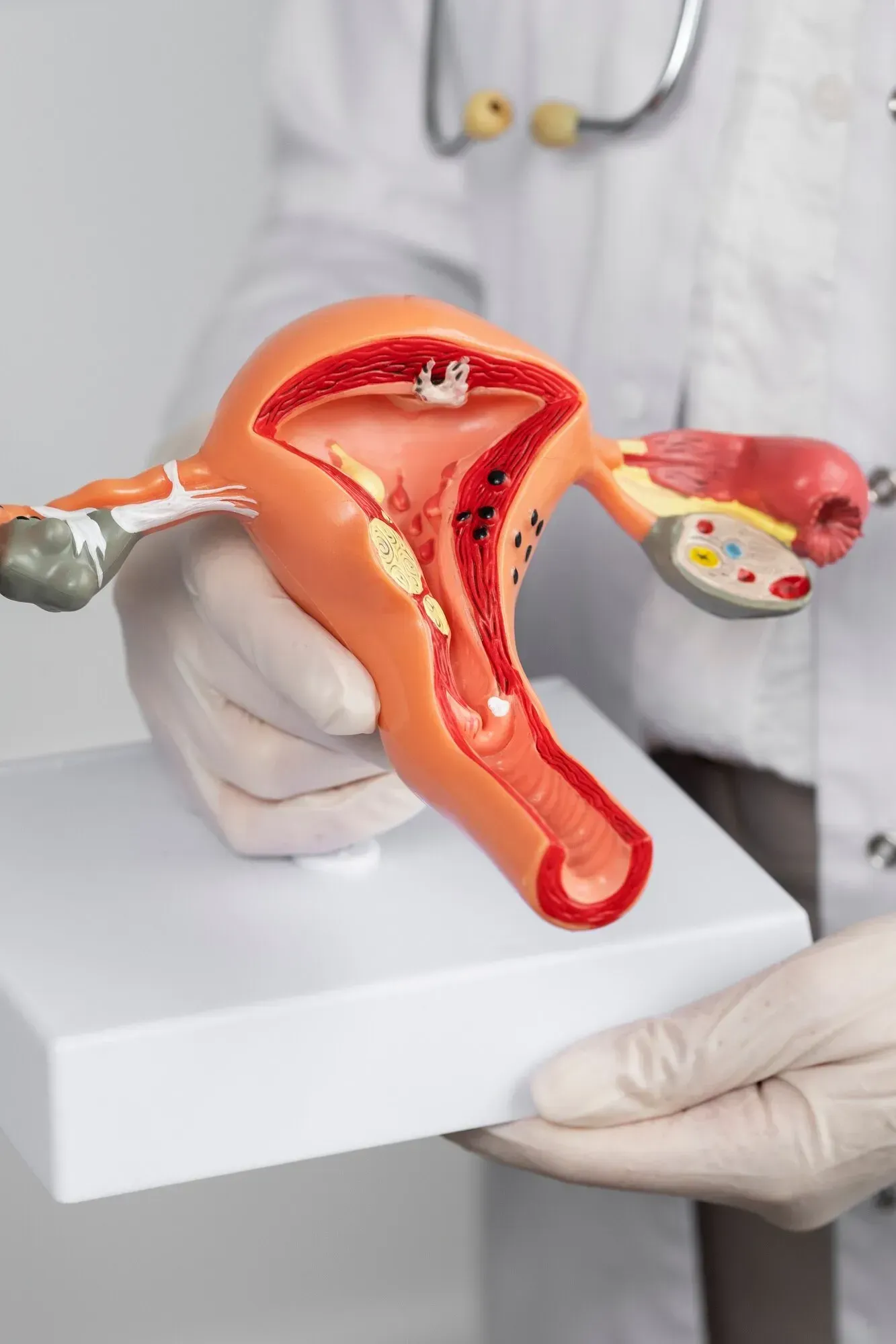 Soins urologiques