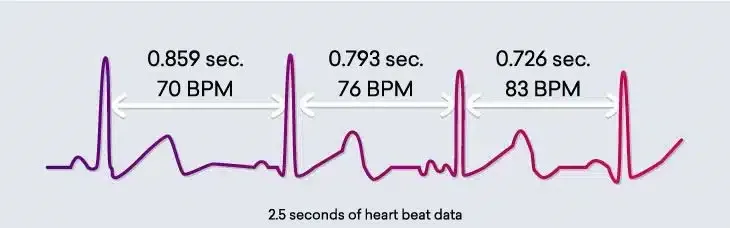HRV
