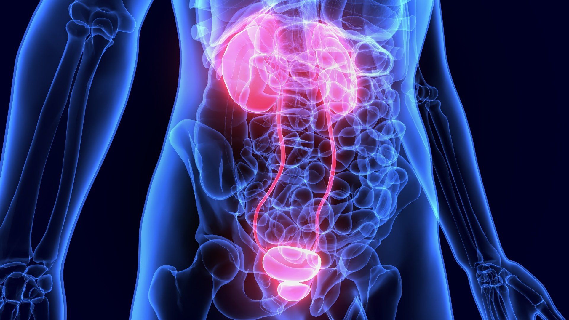 tratamento da cólica renal tratamento da cólica renal