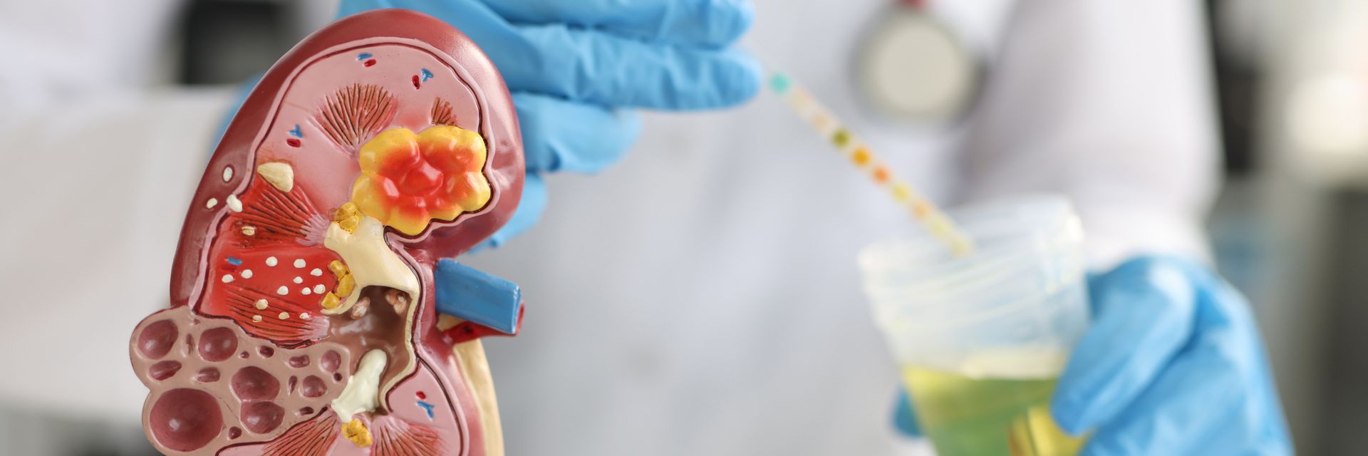 Como é feito o exame de estudo urodinâmico Como é feito o exame de estudo urodinâmico