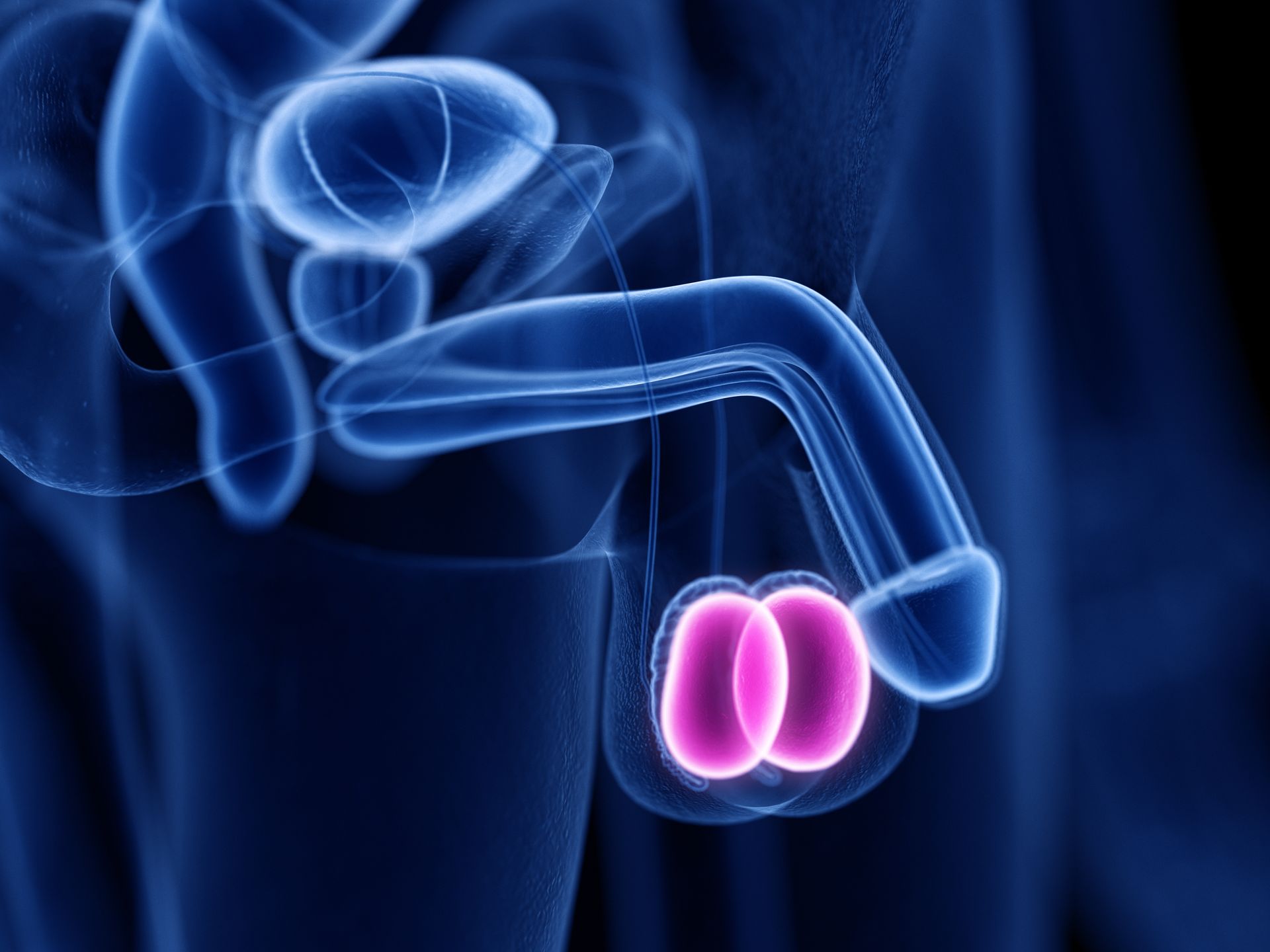 Quando a cirurgia para hidrocele é recomendada Quando a cirurgia para hidrocele é recomendada