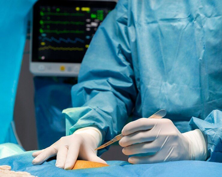Diferenças entre cirurgia robótica e cirurgia tradicional de próstata Diferenças entre cirurgia robótica e cirurgia tradicional de próstata