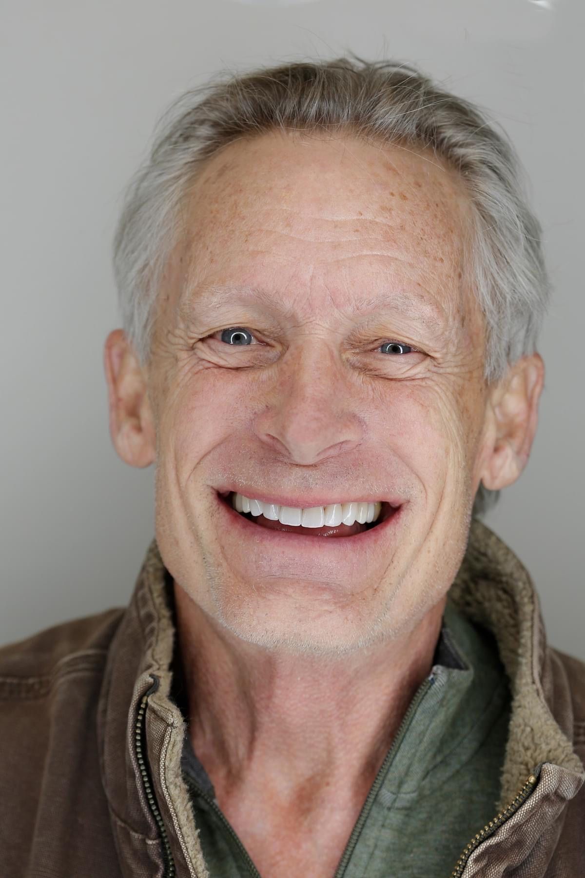 Porcelain Veneers Cosmetic Dentist Denver, CO