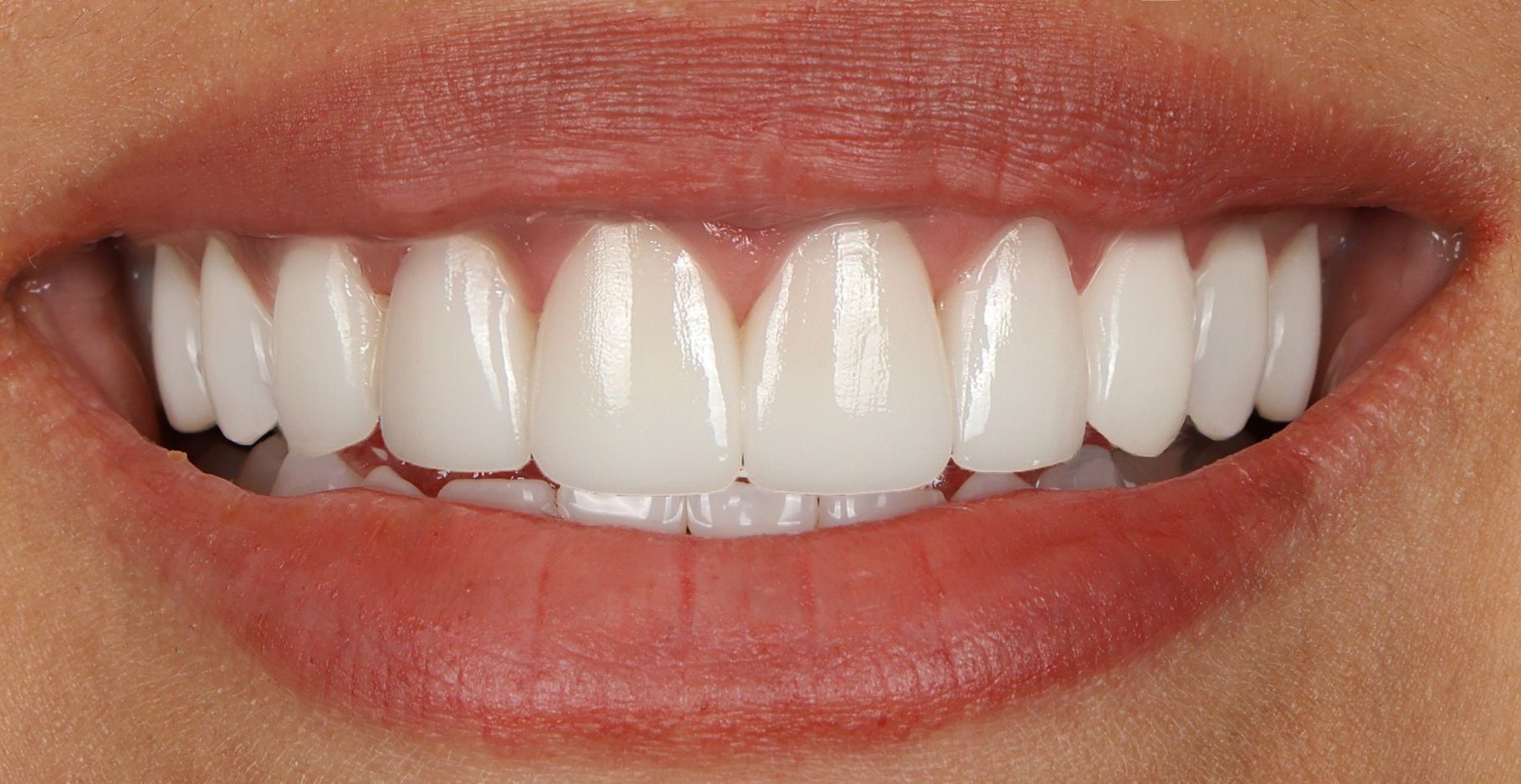 Close-up of a smiling mouth with bright white teeth and pink lips