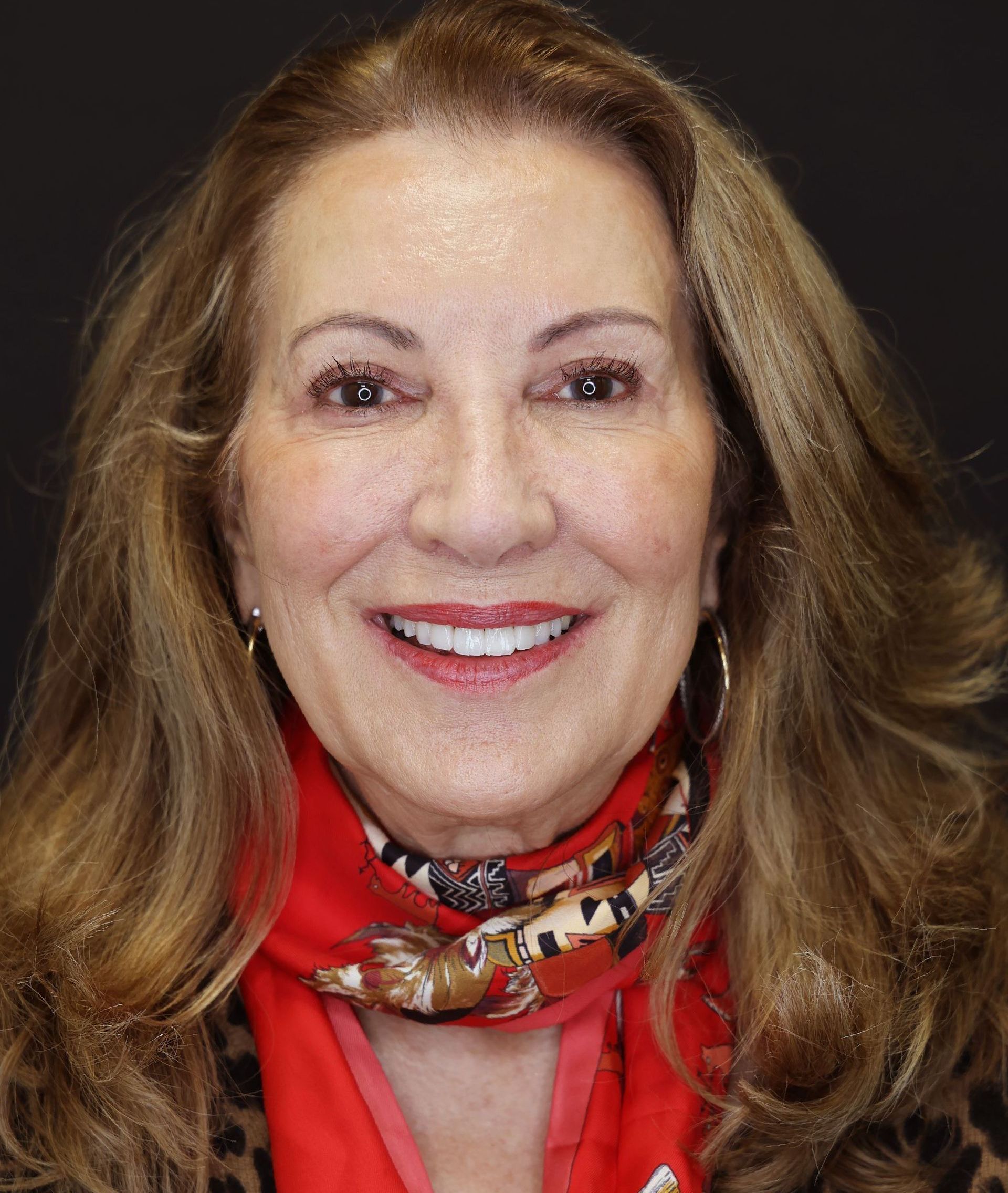 A woman with Porcelain restorations to crate a stong white smile that is long lasting