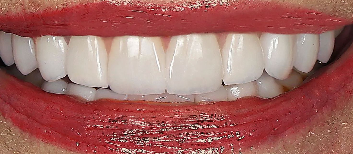 Close-up of a smiling mouth with white teeth and glossy red lipstick
