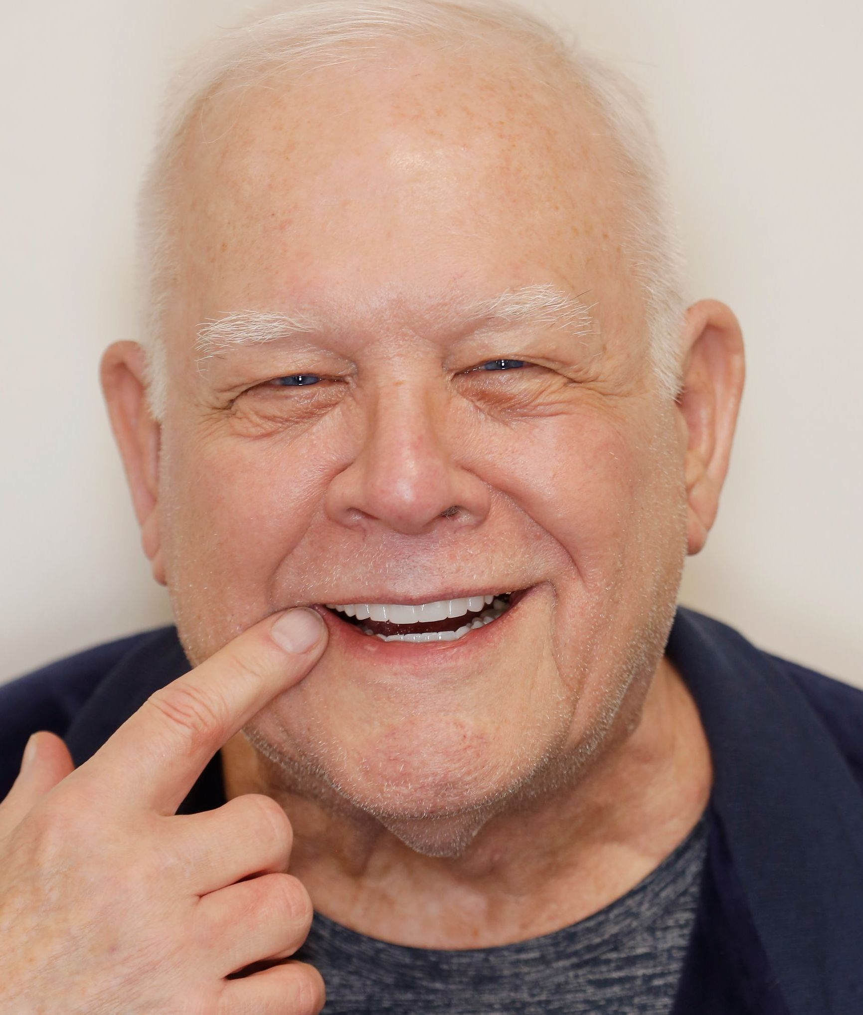 Smiling man pointing to a tooth with a finger, wearing a dark shirt against a light background