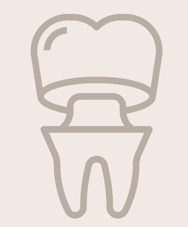 Stylized outline of a tooth with a dental crown above it, in beige tones