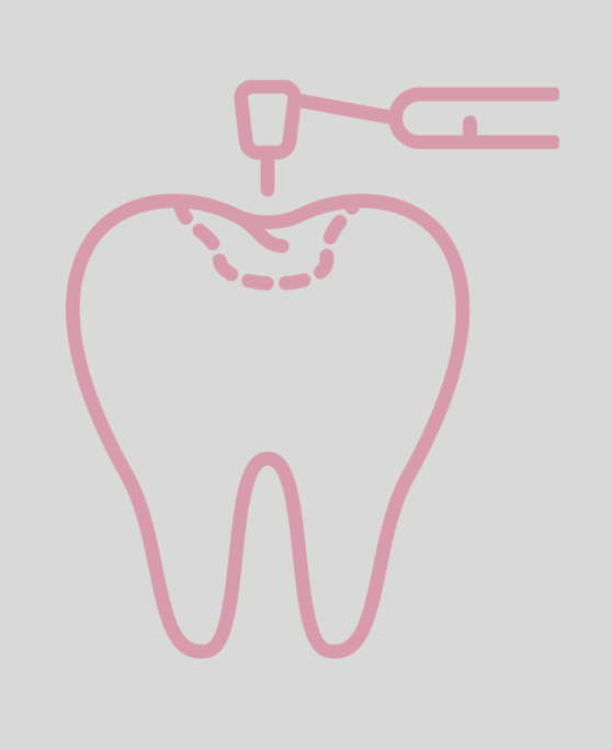 Pink line drawing of a tooth with a dental tool applying treatment to the top surface